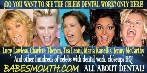 Join Now to get access to the Biggest Collection of Dental Images and video available on the web, with content added everyday!